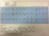 ekg.jpg