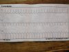 EKG 1.jpg