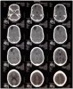 Head CT scan.jpg