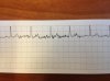 EKG.jpg