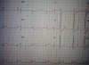 ecg1.jpg