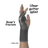 adult_hand_fx_ulnar_gutter_splint1329157869356.jpg