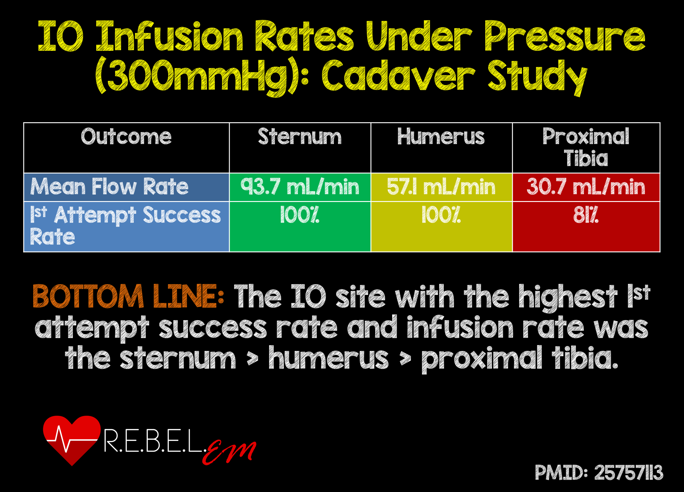 Large Bore IVs and Rapid Infusion EMTLIFE