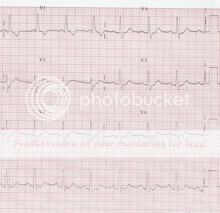 ECG14b.jpg