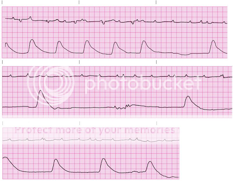 MegaEKG.jpg