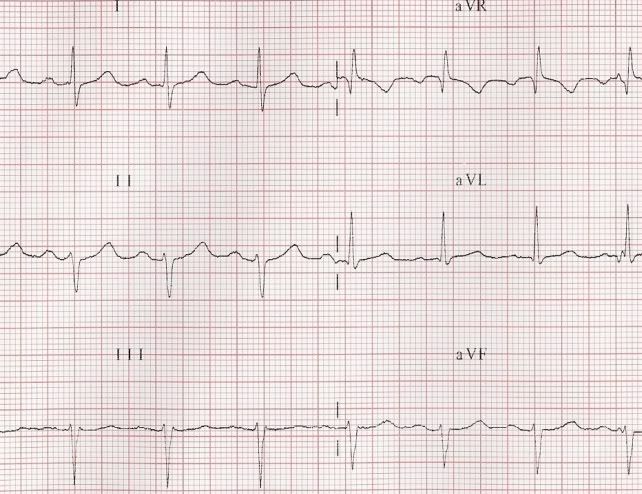 ECG04a.jpg