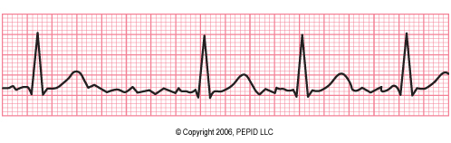 afib1.jpg