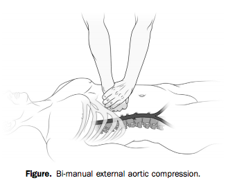 aorta.png