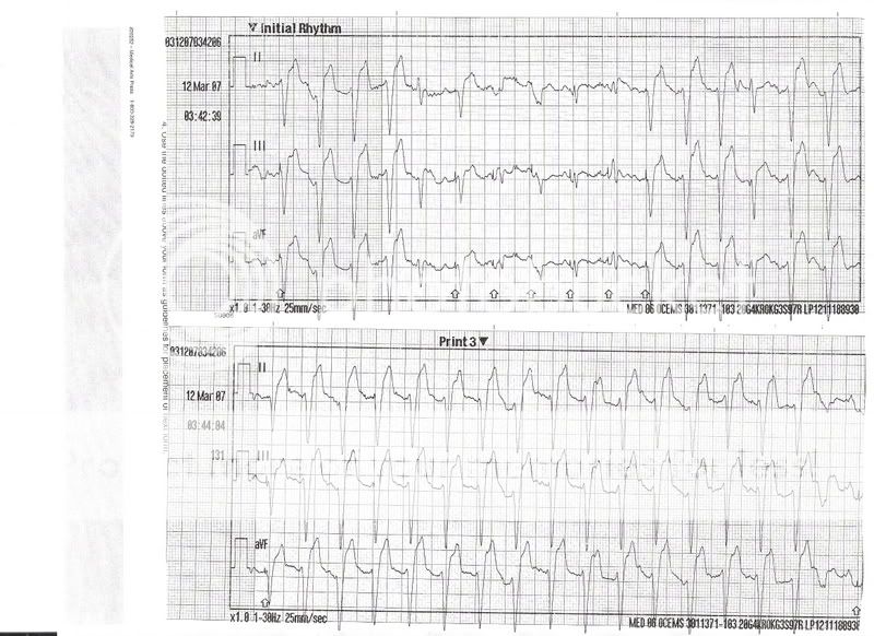 ECG6second.jpg