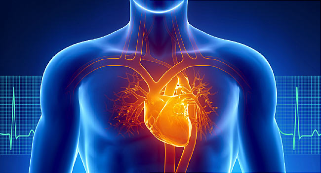 SCA%20NEJM(1).jpg