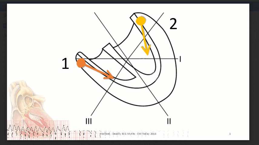 VT-axis-graphic.png