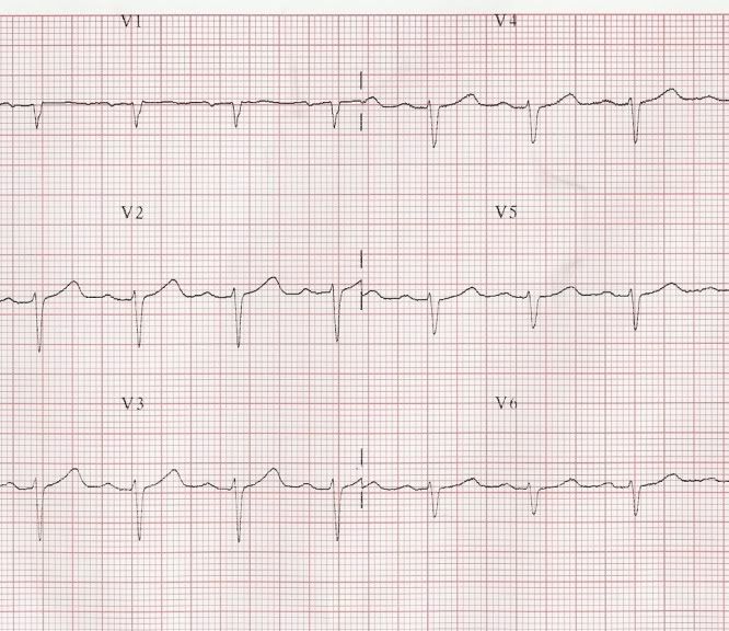 ECG04b.jpg